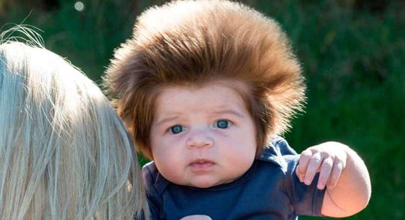 الطفل صاحب أكثف شعر في العالم