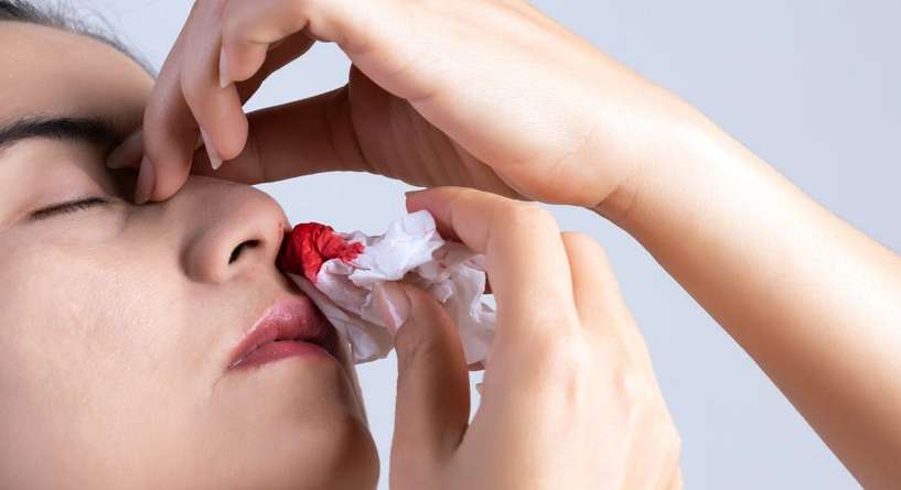 اسباب نزيف الانف المفاجئ وطرق العلاج