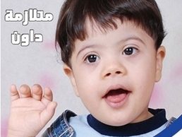 كيف تساعد الأم طفلها المصاب بمتلازمة داون؟