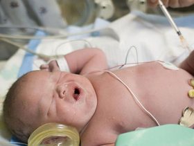 تطعيمات الاطفال المولودين قبل اوانهم