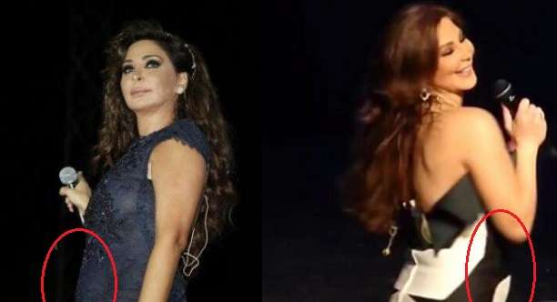 كرس أليسا
