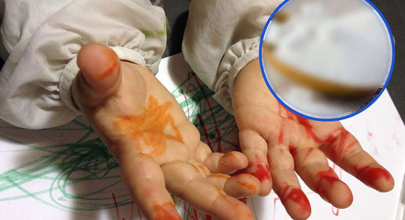 مكون واحد يزيل بقع الحبر عن جسم الطفل