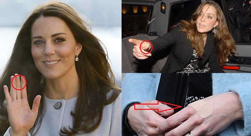 ماذا تخفي كيت ميدلتون تحتب اللصقات في يدها؟