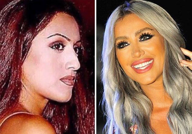 مايا دياب قبل التجميل