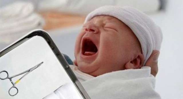 حكم الختان في الاسلام