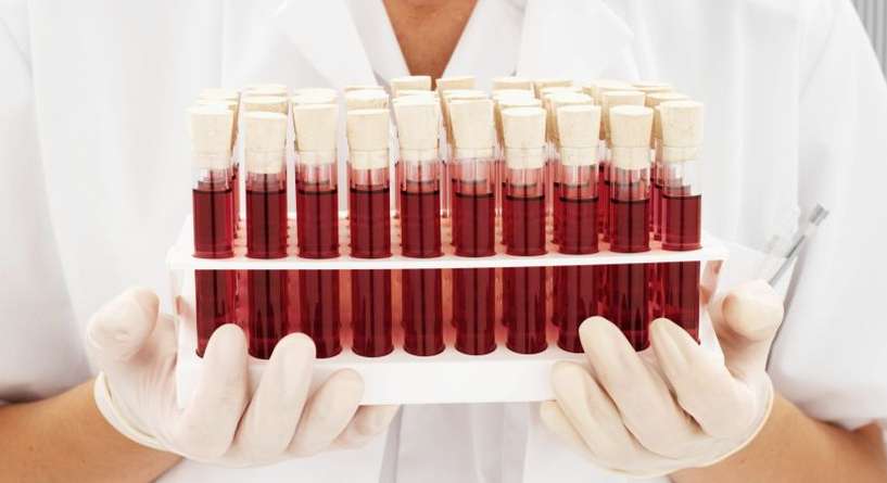 5 أمور تكشفها فئة الدم عن الصحة