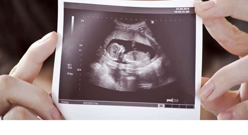 كيف اعرف نوع الجنين من ورقة السونار