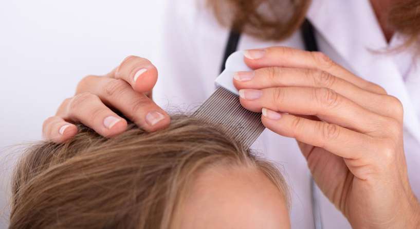 اسباب قشرة الشعر عند الاطفال 