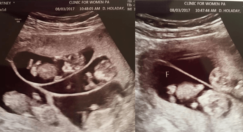 أم قررت الإنجاب للمرة الرابعة فحصل ما لم يكن في الحسبان!