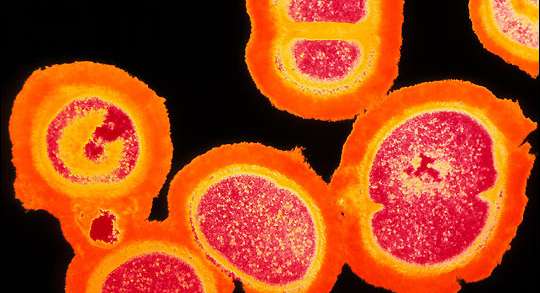 بكتيريا خارقة وقاتلة في الخليخ | Superbugs، أمراض، صحة