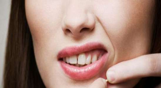 علاج حب الشباب| العناية بالبشرة، تنظيف البشرة