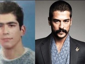 صور صادمة لأشكال النجوم الأتراك قبل الشهرة