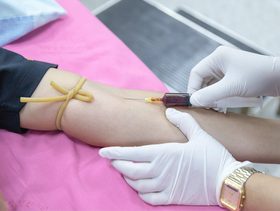 متى يصبح الكوليسترول خطرا 