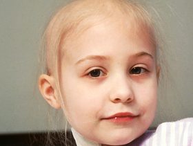 اعراض السرطان عند الأطفال
