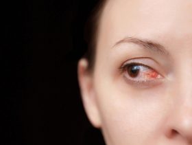 التهاب عضلة القلب