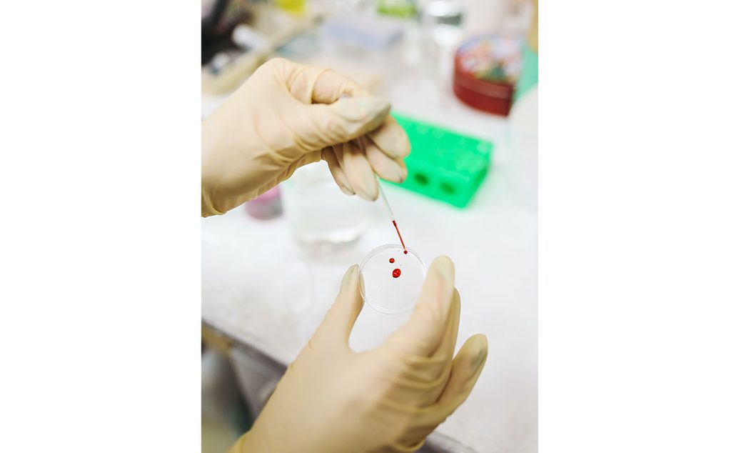 معدّات فحص الدم في المختبر