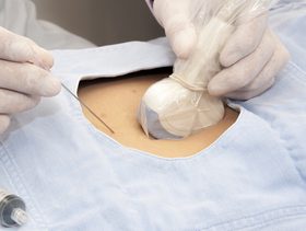 سونار البطن ماذا يكشف؟