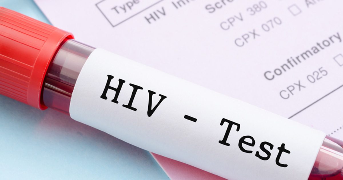 تشخيص الإيدز فهل يظهر في تحليل الدم العادي؟