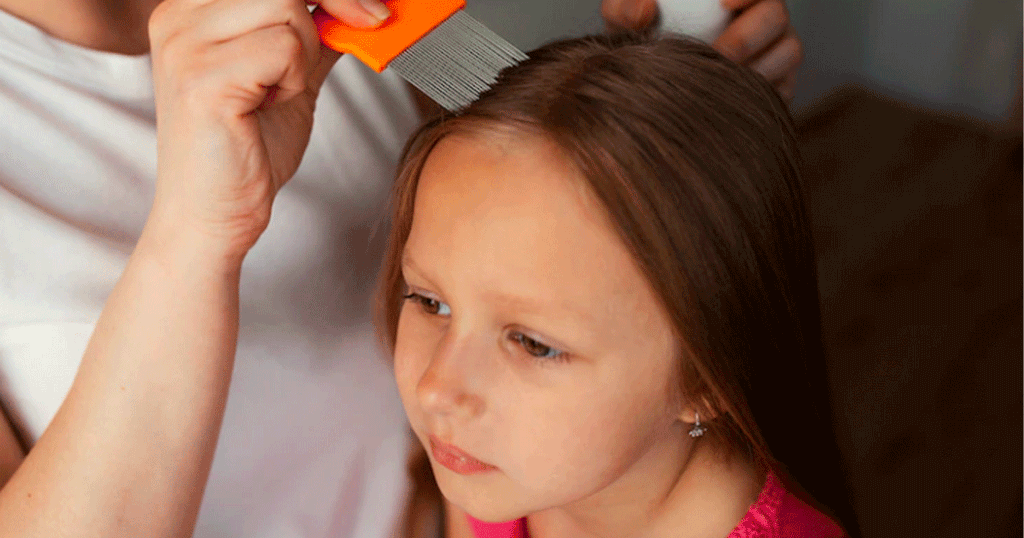 تخلّصي من قمل الأطفال في المنزل