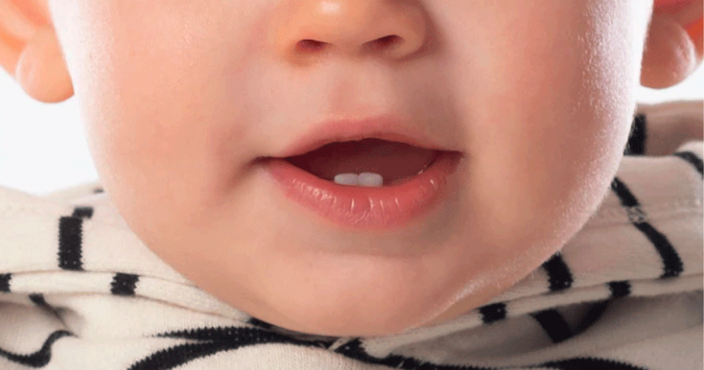 عوارض التسنسن الخطيرة