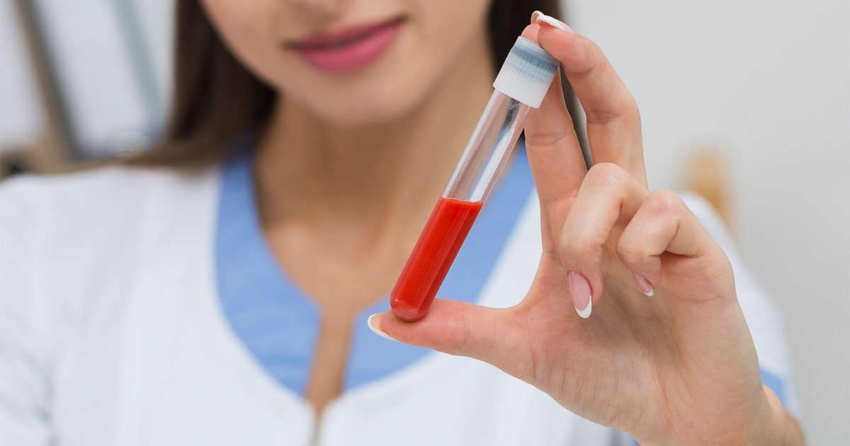 كيفية الحفاظ على نسبة دم الحامل