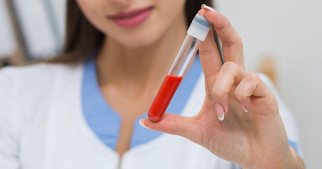 كيفية الحفاظ على نسبة دم الحامل