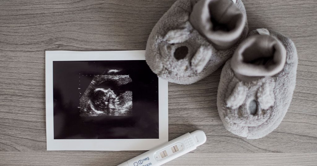 دلالات السونار للحامل