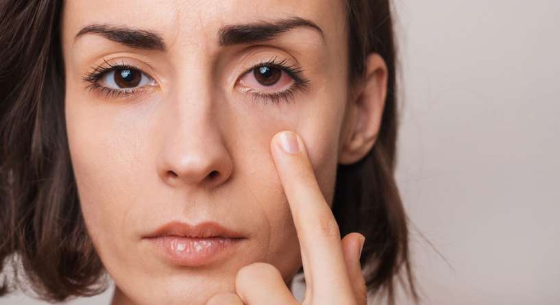 أعراض التهاب العين