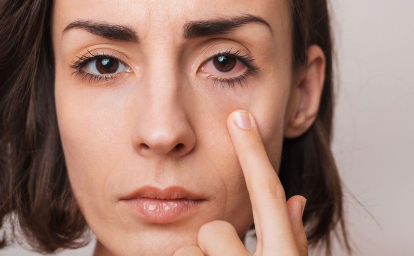 أعراض التهاب العين