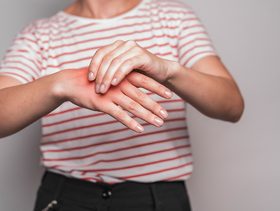 ظهور كدمات خضراء في الجسم بدون سبب