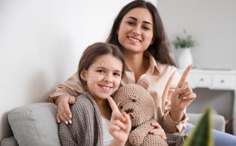 مدة علاج الجدري عند الأطفال