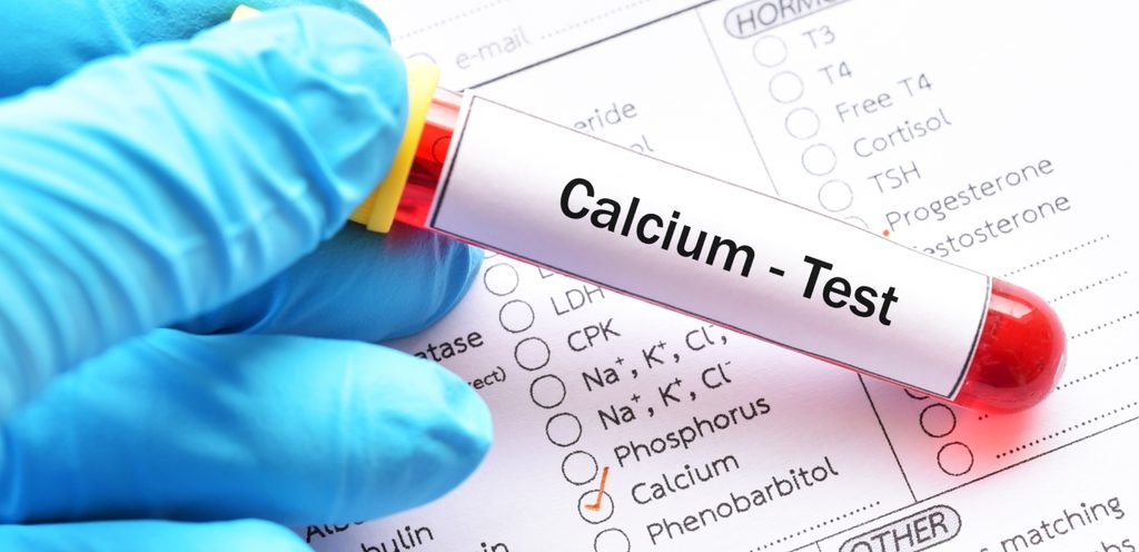 كيفيّة الحفاظ على المعدّل الطبيعي للكالسيوم في الدم