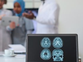 نسبة الشفاء من الورم السحائي_ عوامل الخطورة والعوارض