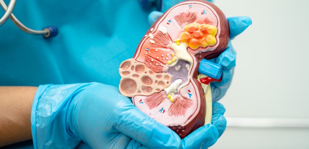 مضاعفات ما بعد غسيل الكلى