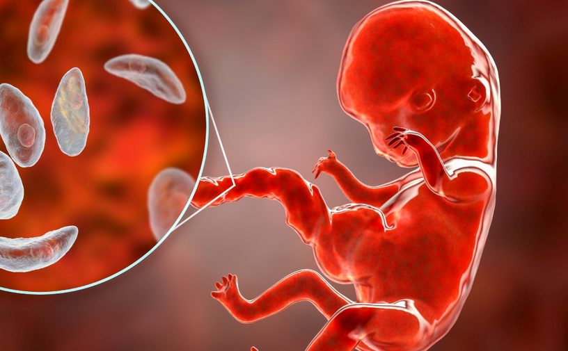 السدادة المخاطية شكل ماء الجنين بالصور