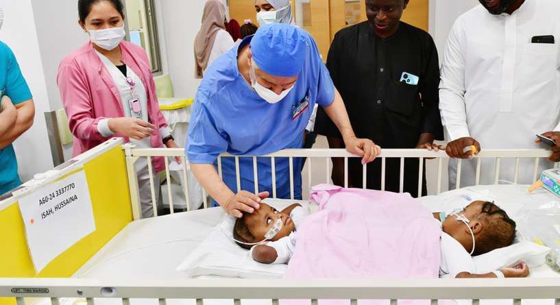 عملية فصل التوأم السيامي النيجيري في الرياض تكلل بالنجاح