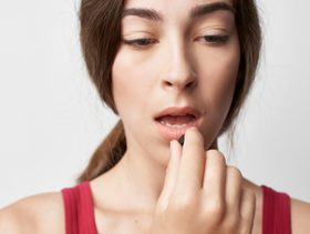 تشقق زوايا الفم نقص فيتامين