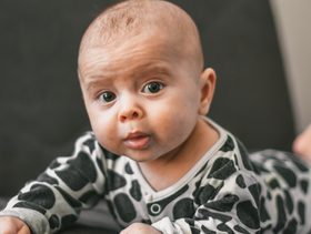 علامات التقزم عند الرضع