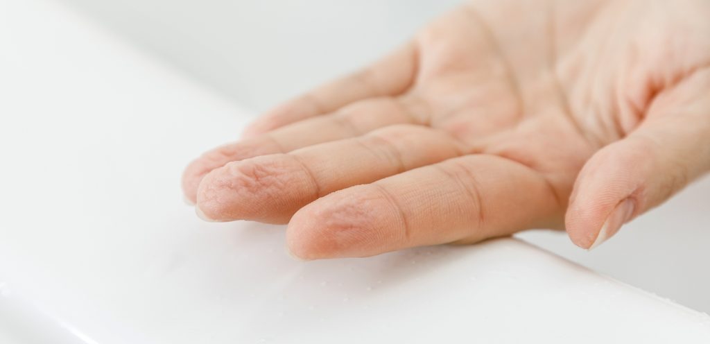 علاج تشققات اليدين والاكزيما في المنزل