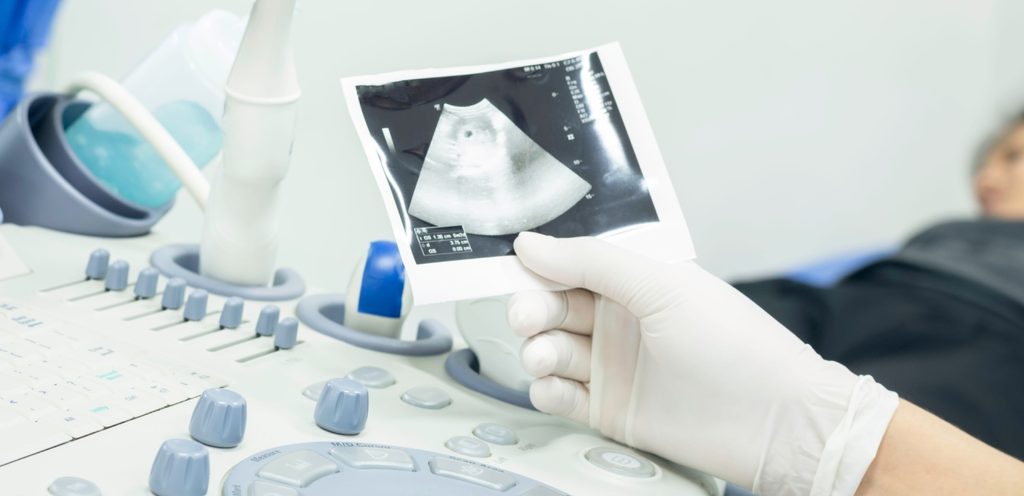 صورة تفصيلية للجنين