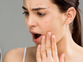 علاج حبوب الوجه الحمراء الملتهبة