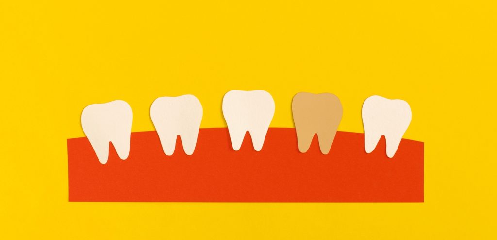 الأسنان الصحيّة وغير الصحيّة