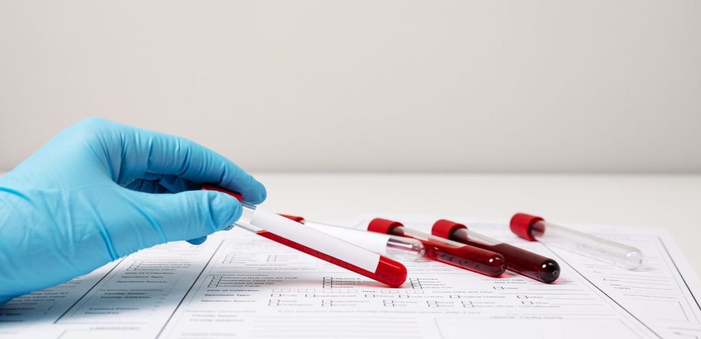 أنبوب فحص الدم