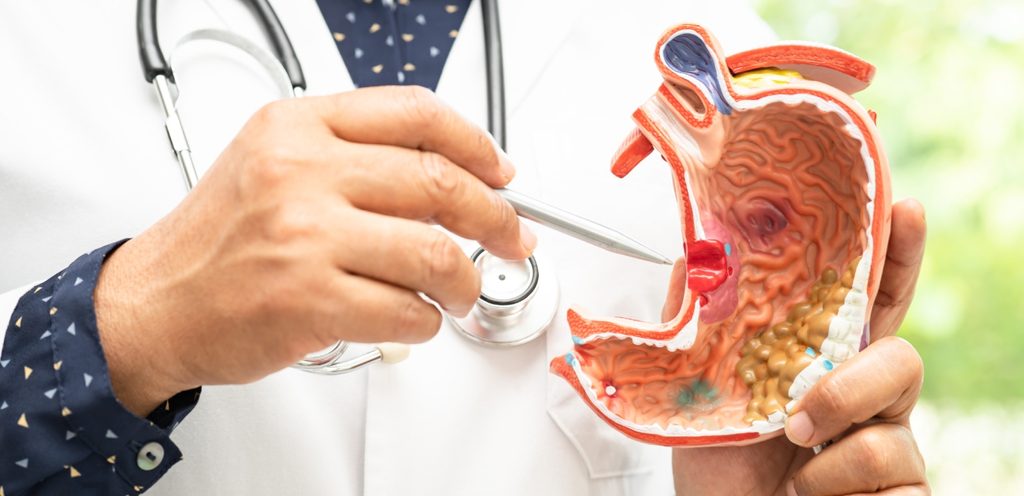 أدوية مطهّرة للمعدة