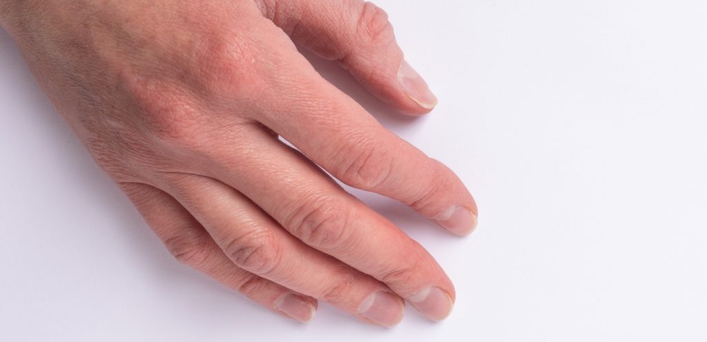 أظافر قصيرة