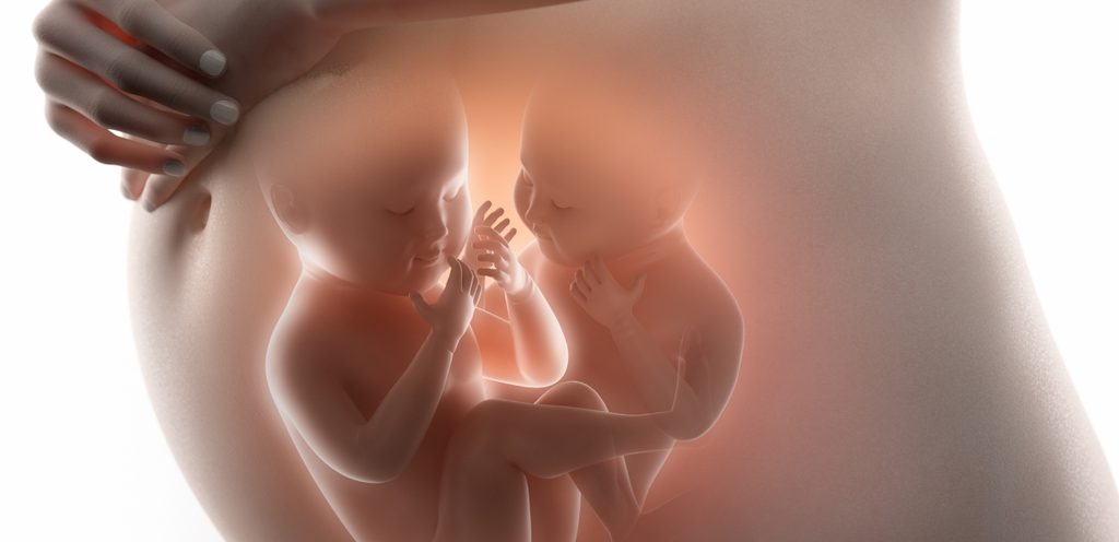 توأم في بطن الأم