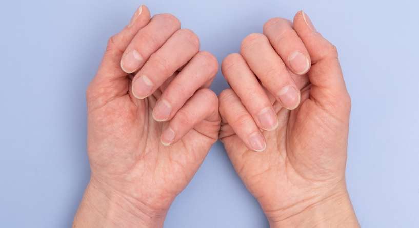 أظافر رقيقة