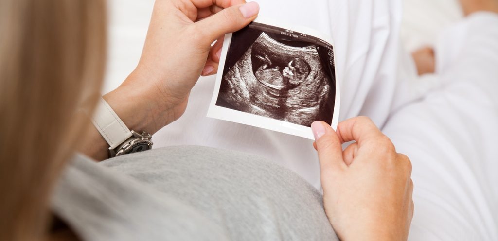 صورة بالموجات فوق الصوتية للجنين