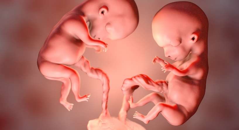 توأم جنين في بطن الحامل