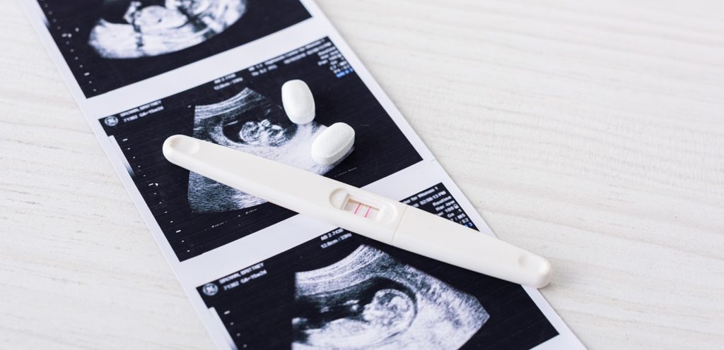 اختبار حمل موجود على صورة سونار وحبّتين من الدواء